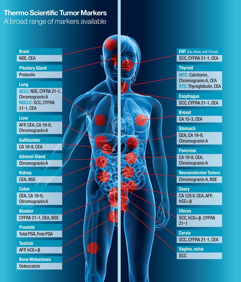 tumor-markers-oncology.jpg
